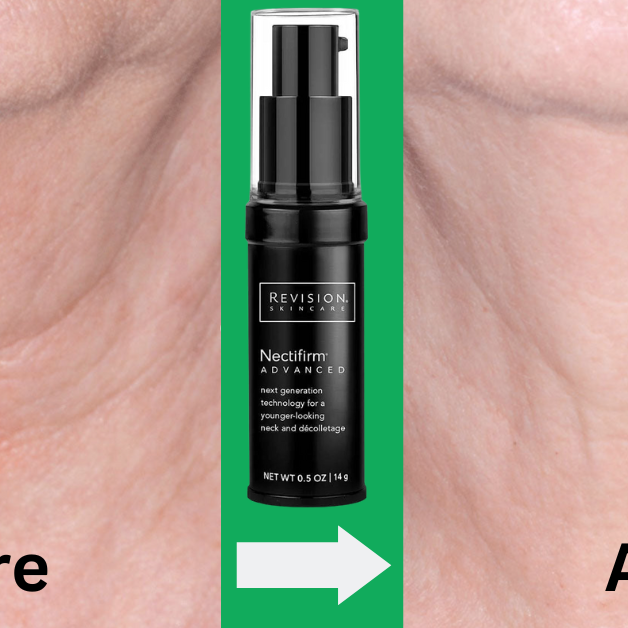 "The Neck's Secret to Youthful Beauty: Nectifirm® ADVANCED"