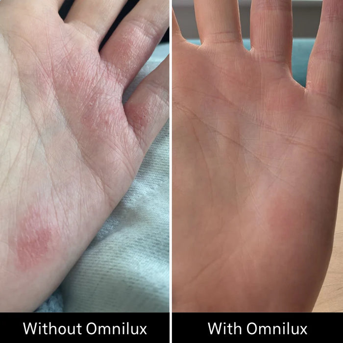 Omnilux Contour Glove