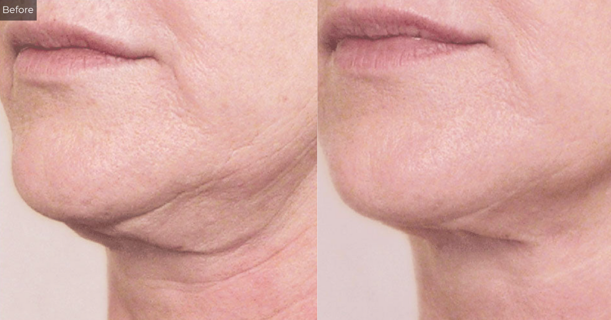 Why Your Neck and Decolletage Need a Skincare Routine. — Longevity Texas