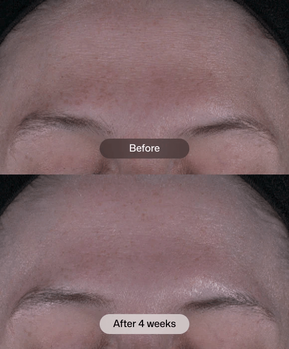 Tone+ Correcting Pads™ 30 Pads